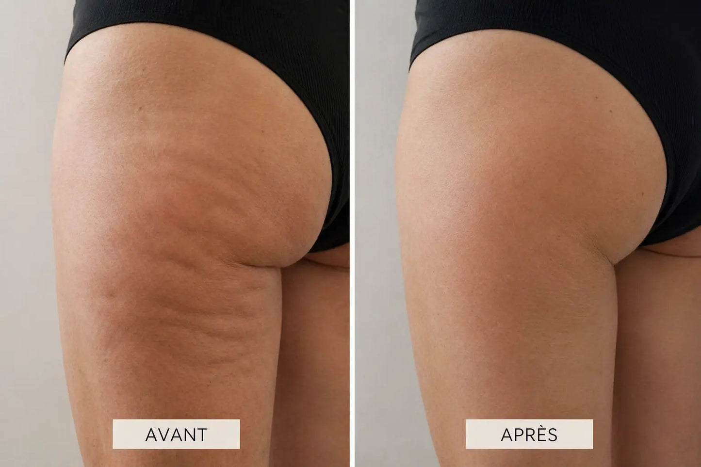 Rituel Sculptant anti-cellulite Néolia